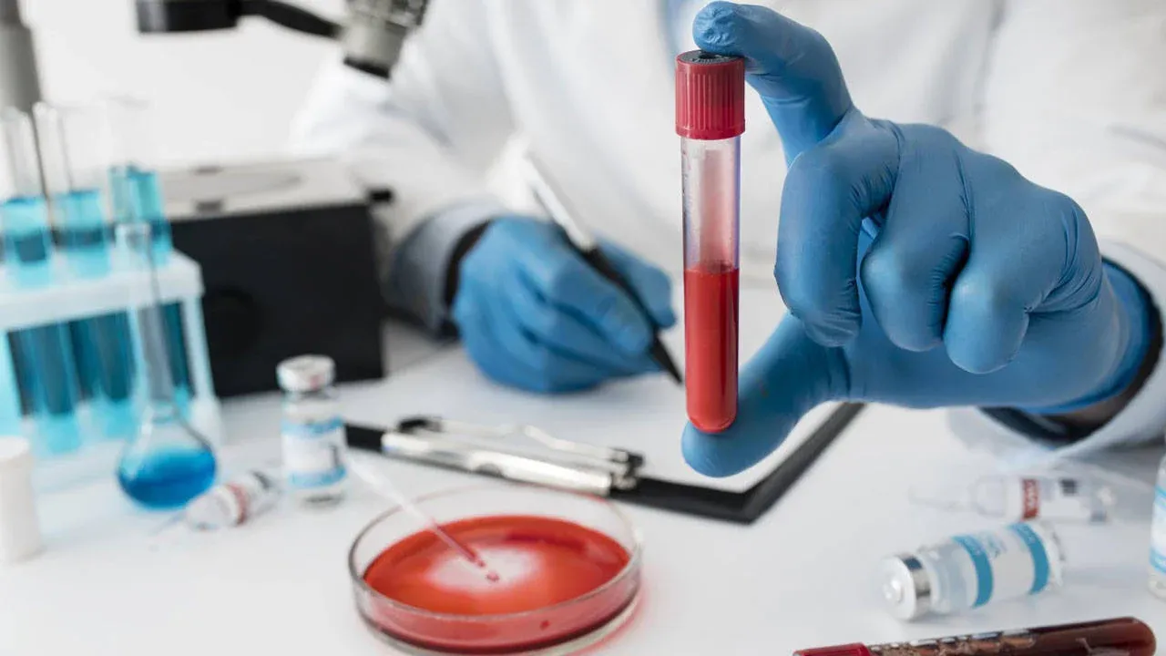 Kan hastalıkları ve hematoloji hakkında bilmeniz gereken her şey!