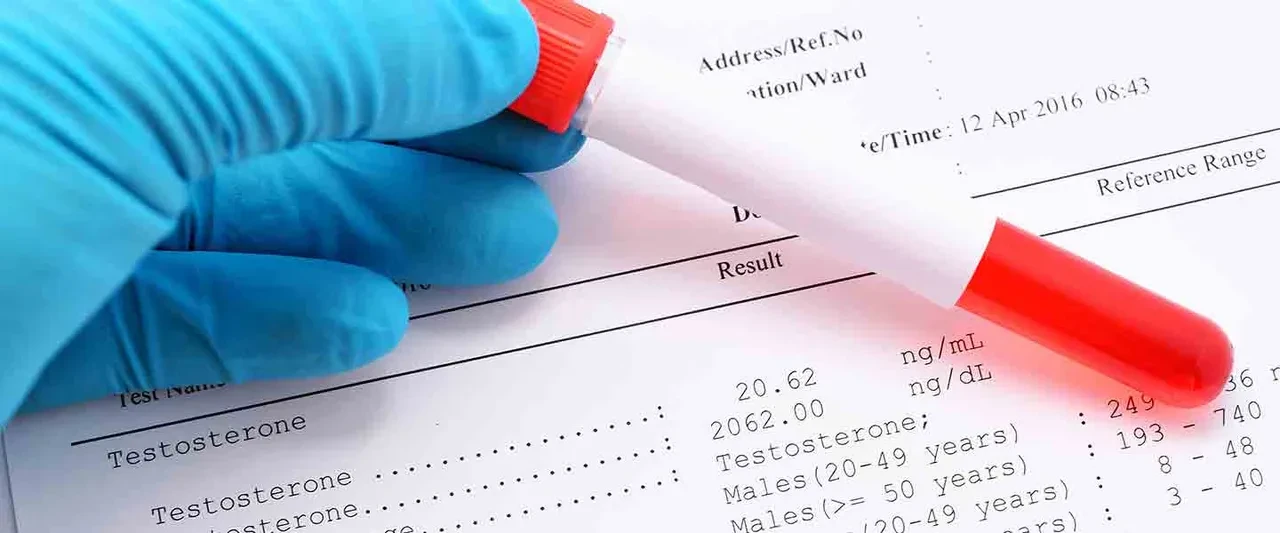 Kan hastalıkları ve hematoloji hakkında bilmeniz gereken her şey!