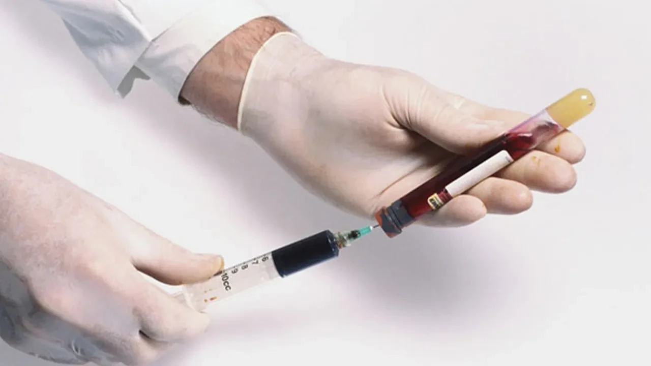 Kan hastalıkları ve hematoloji hakkında bilmeniz gereken her şey!