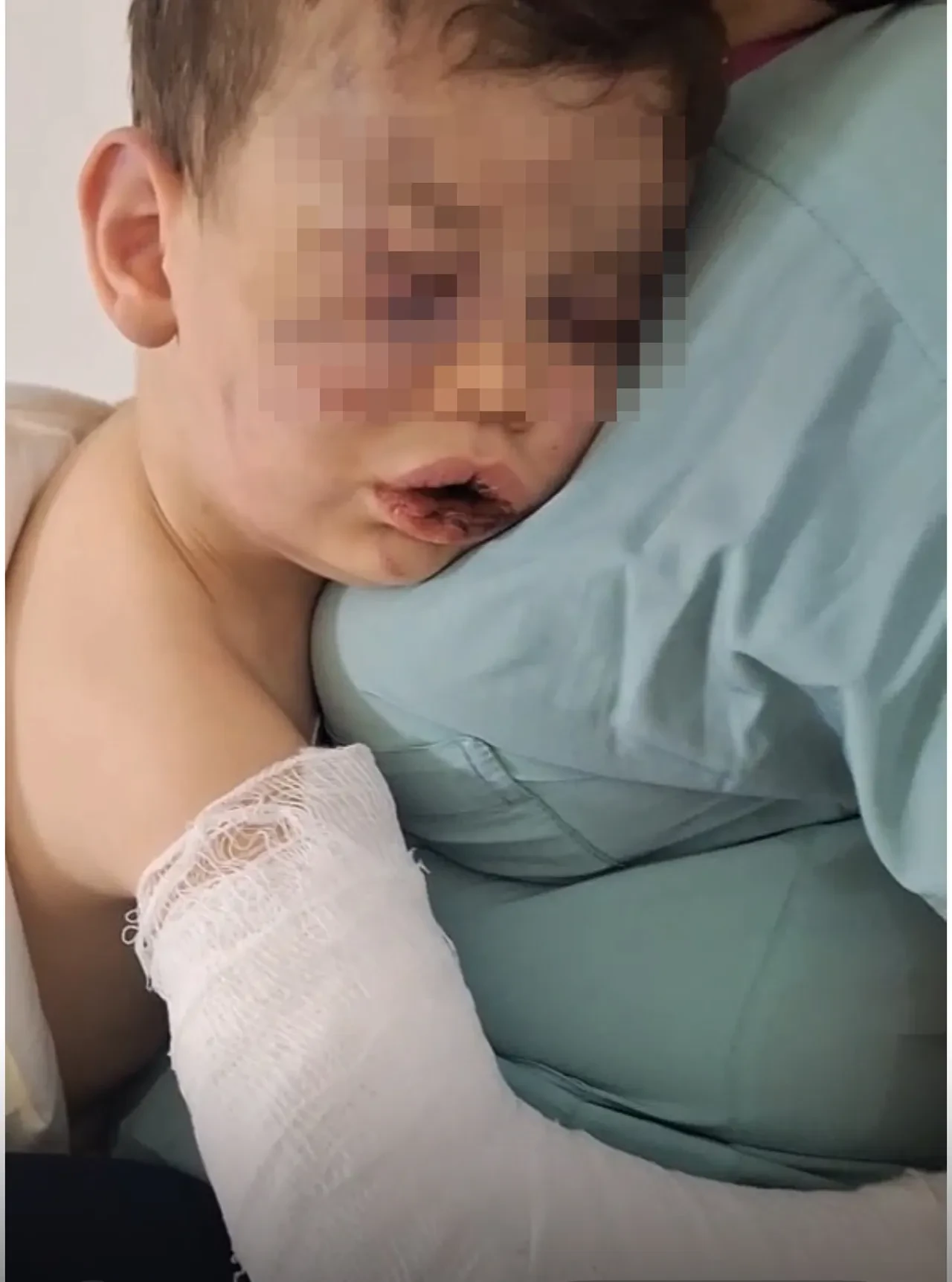 Denizli'de vahşet! 2 yaşındaki bebeği öldüresiye dövüp yakmaya çalıştılar