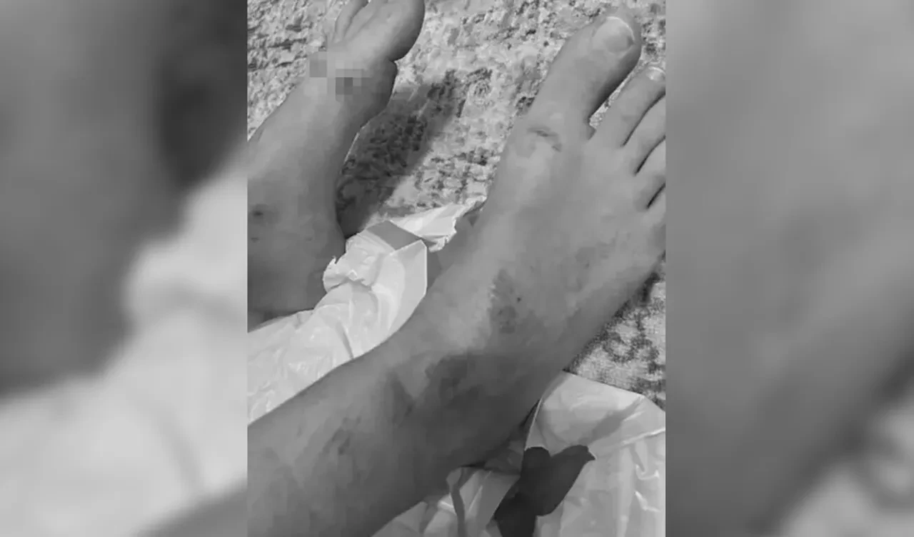 Disney World tatili korku dolu kabusa dönüştü: Yaralanan kadından dudak uçuklatan tazminat davası