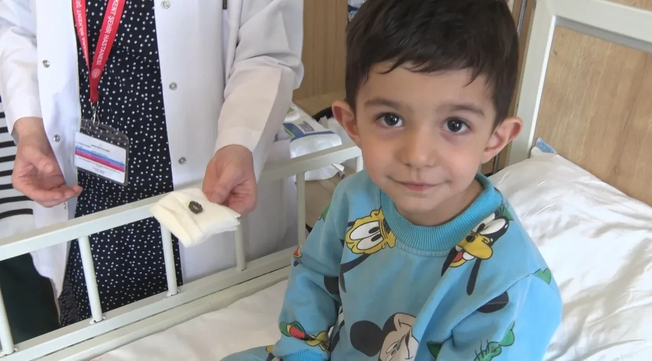 Ailesi fark etti! Bağırsağından 7 adet mıknatıs çıktı!