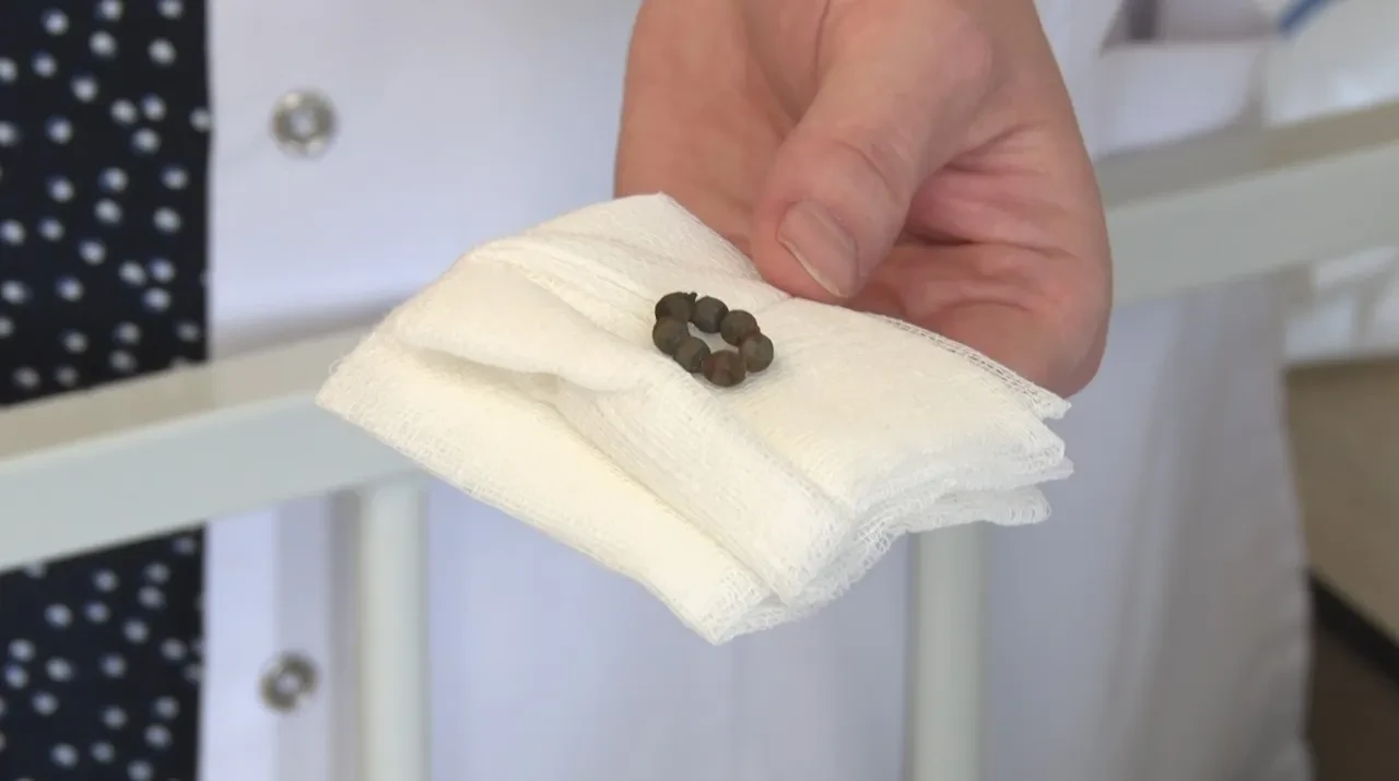 Ailesi fark etti! Bağırsağından 7 adet mıknatıs çıktı!