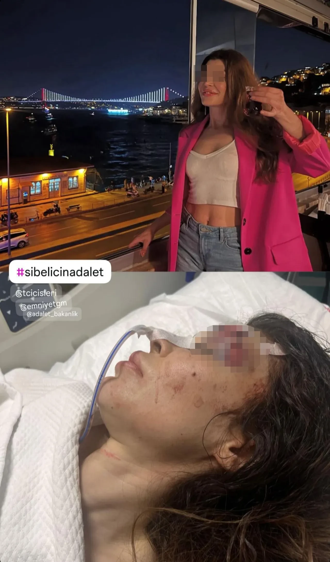 Kadın şiddetine Beşiktaş Belediyesi'nden müdahale