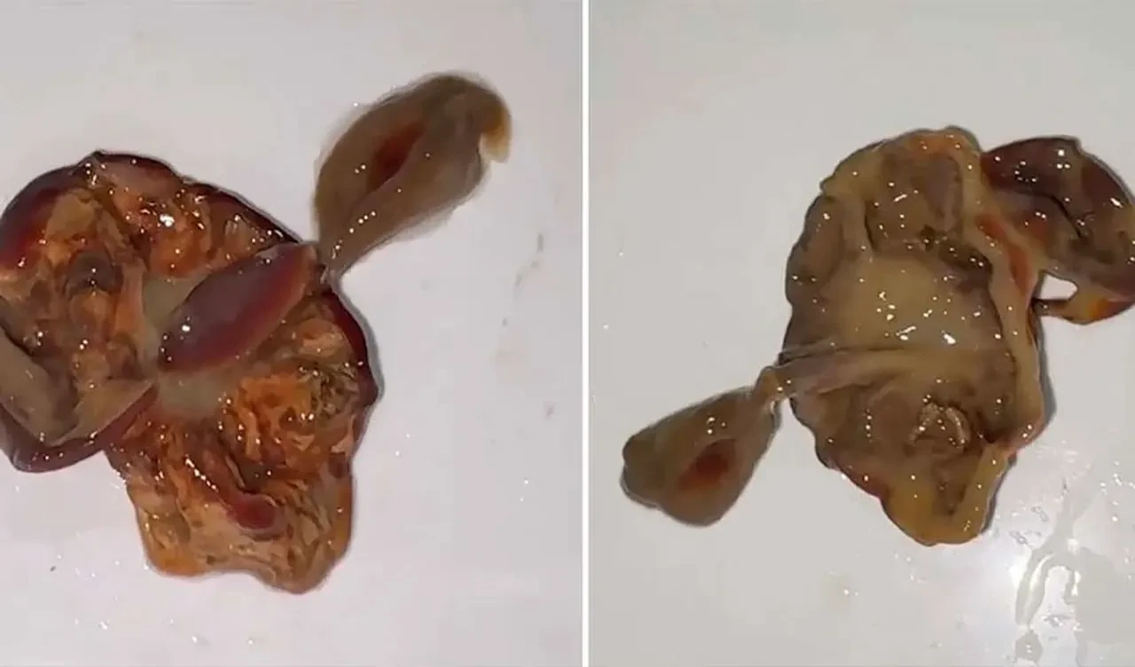 Meyve suyundan çıktı, herkesin midesi bulandı! Ne olduğu ise muamma