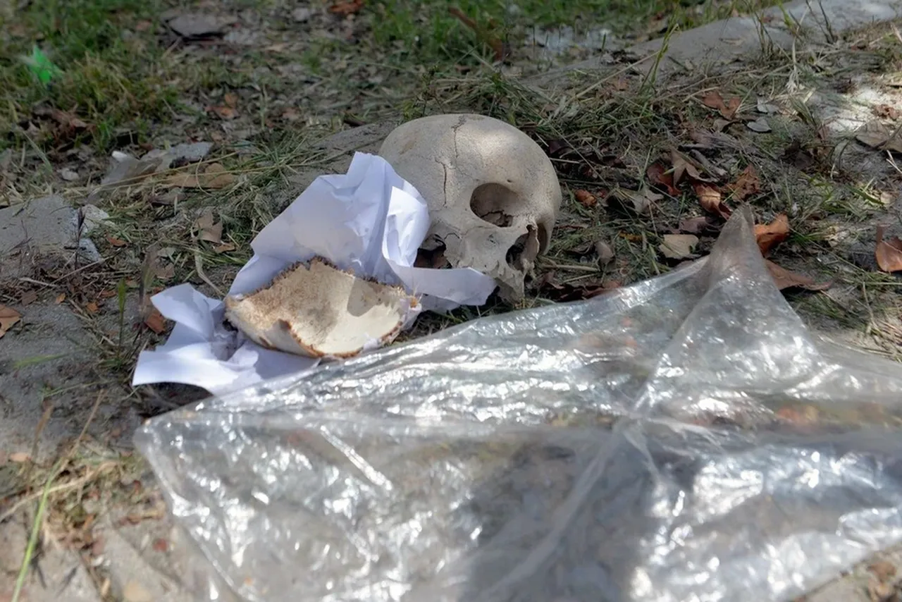 Çöpteki kafatasının sırrı çözüldü! Eşi yıllarca saklamaktan bıkıp çöpe atmış