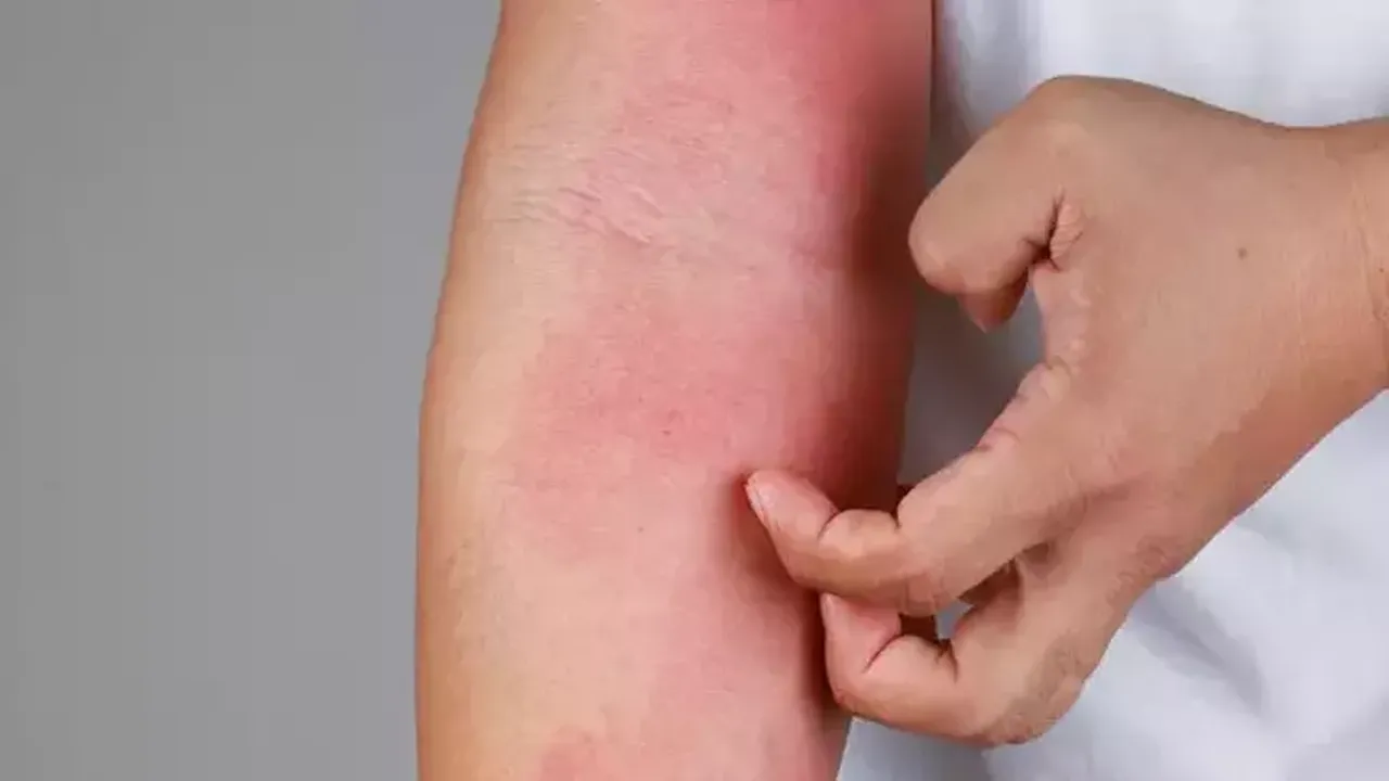 Kimse bu hastalığı bilmiyor ama içimizde bir yerde sinsi sinsi bekliyor