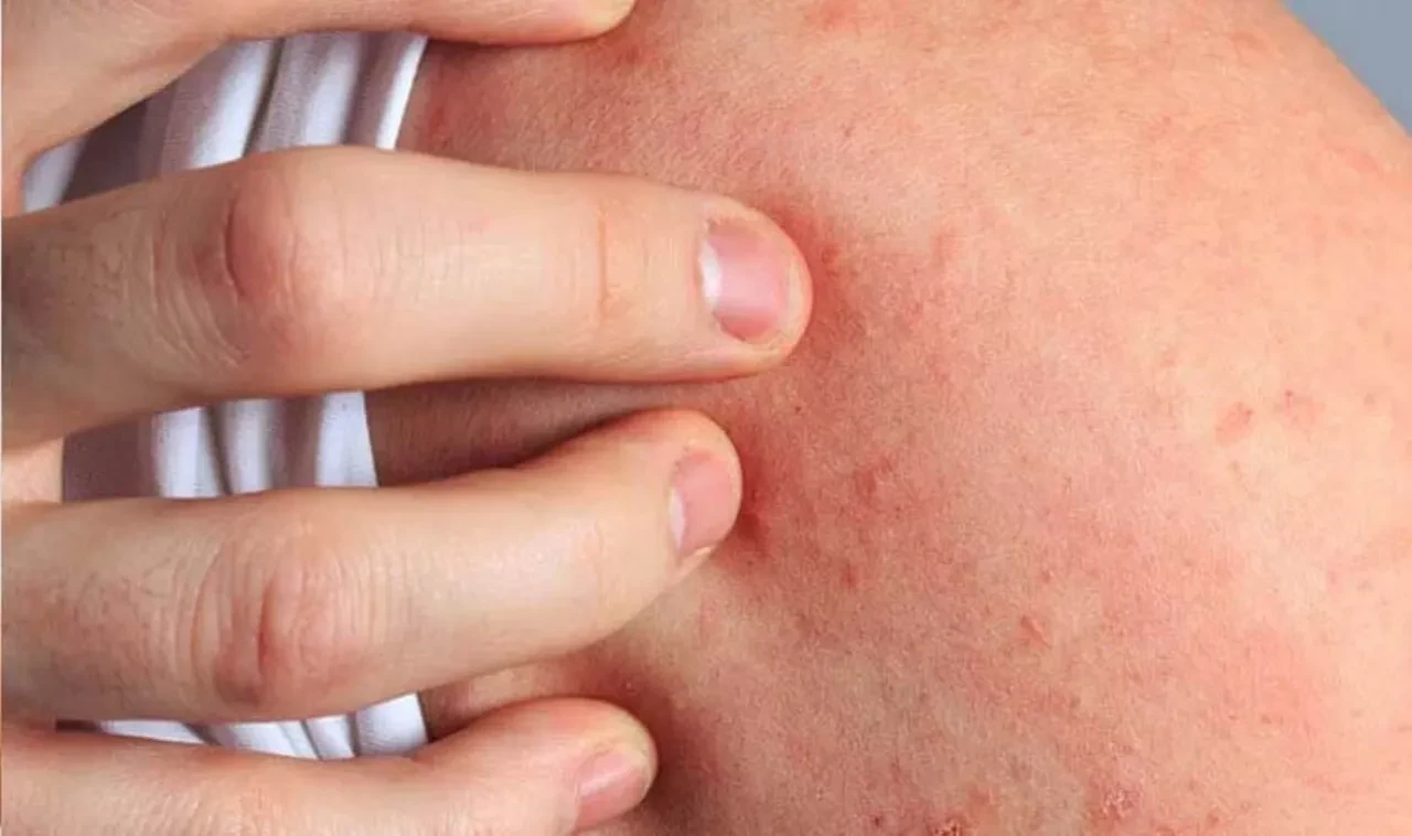 Kimse bu hastalığı bilmiyor ama içimizde bir yerde sinsi sinsi bekliyor