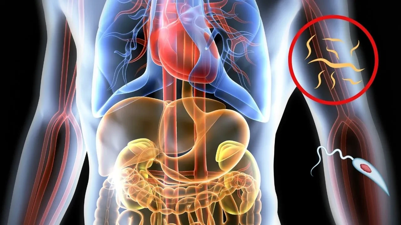 1 milyondan fazla kişi iç parazitle yaşıyor! Bu belirtiler varsa acilen doktora görünün