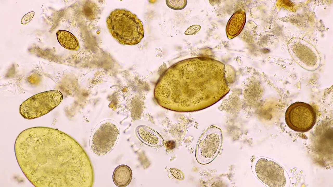 1 milyondan fazla kişi iç parazitle yaşıyor! Bu belirtiler varsa acilen doktora görünün