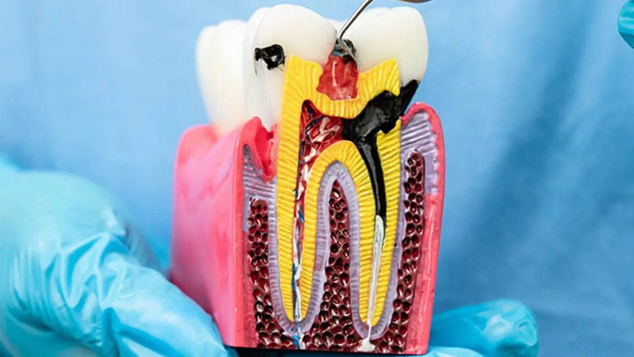 Geceleri horlayanlar dikkat! Diş eti kanamalarıyla başlıyor, dişlerin dökülmesine kadar gidiyor