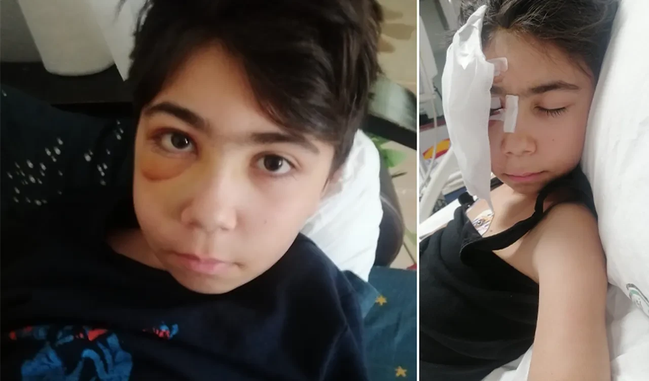 Kafasına kale direği düştü! 13 yaşındaki çocuğun hayatı kabusa döndü!