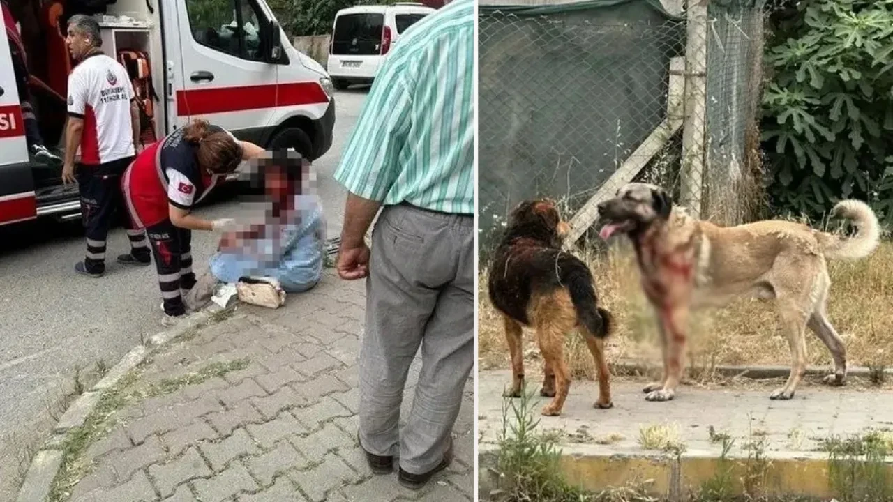 İstanbul'da köpek dehşeti! 'Kafamı ısırdı, gözümü kaybettim'
