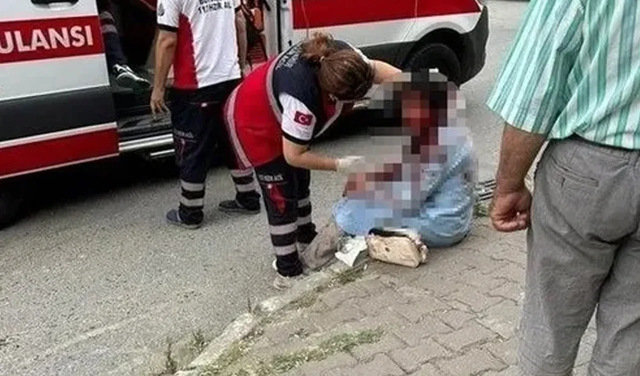 İstanbul'da köpek dehşeti! 'Kafamı ısırdı, gözümü kaybettim'