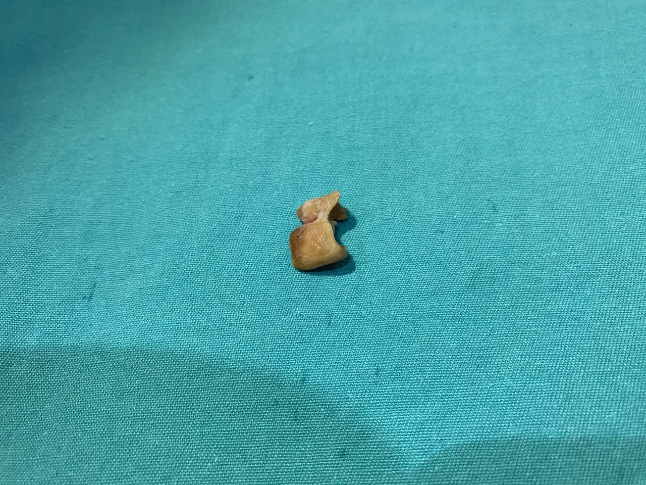 Sabah uyandığında büyük şok yaşadı! Şiddetli öksürük şikayetiyle gitti, acil ameliyata alındı