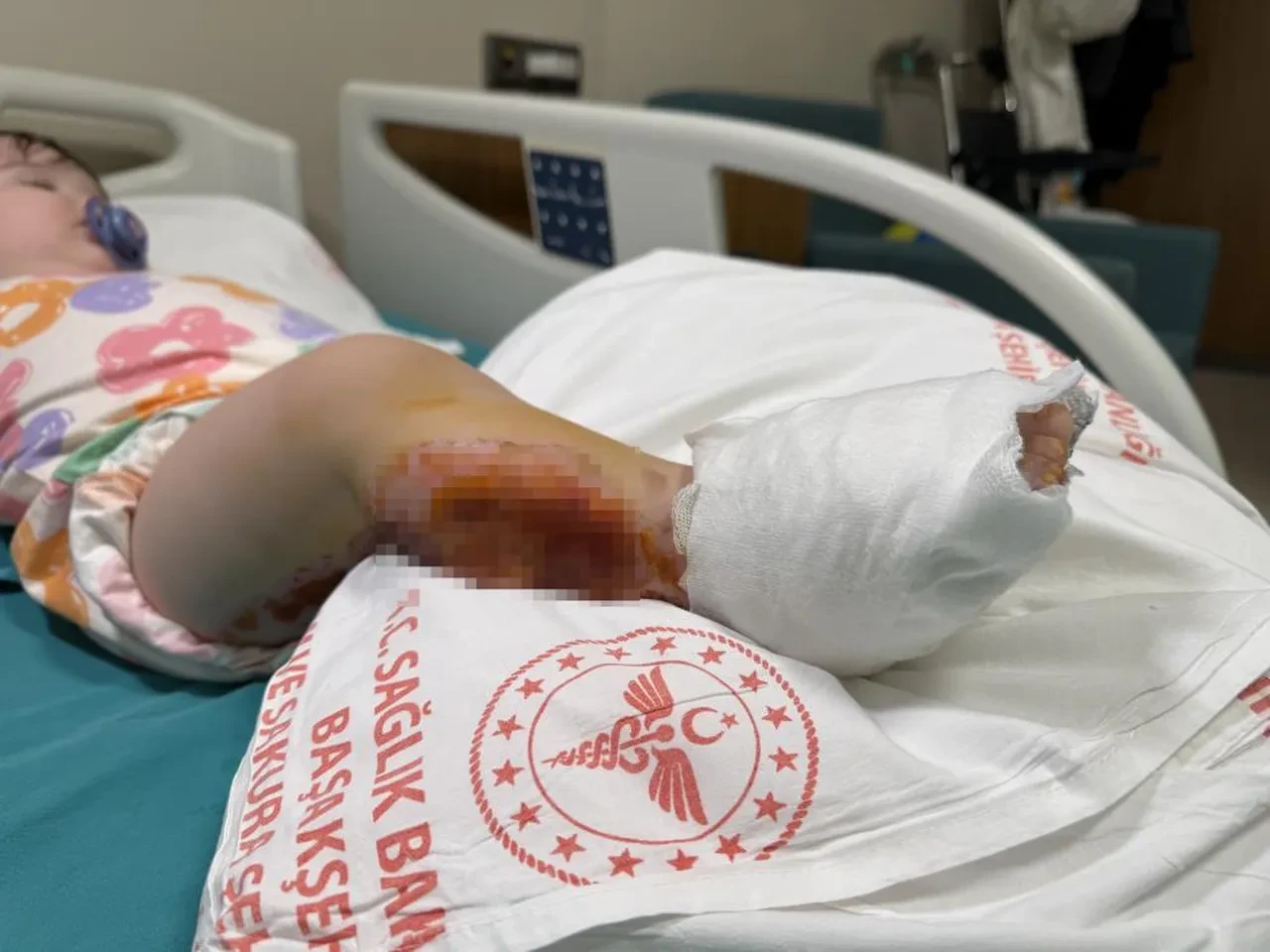 Bir anlık dikkatsizlik faciayla sonuçlanıyordu! Minik Defne dehşeti yaşadı