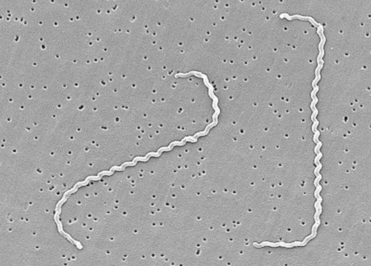 Fareler vebadan sonra ölümcül bir salgına daha neden olabilir! Bakteri yaymaya başladılar