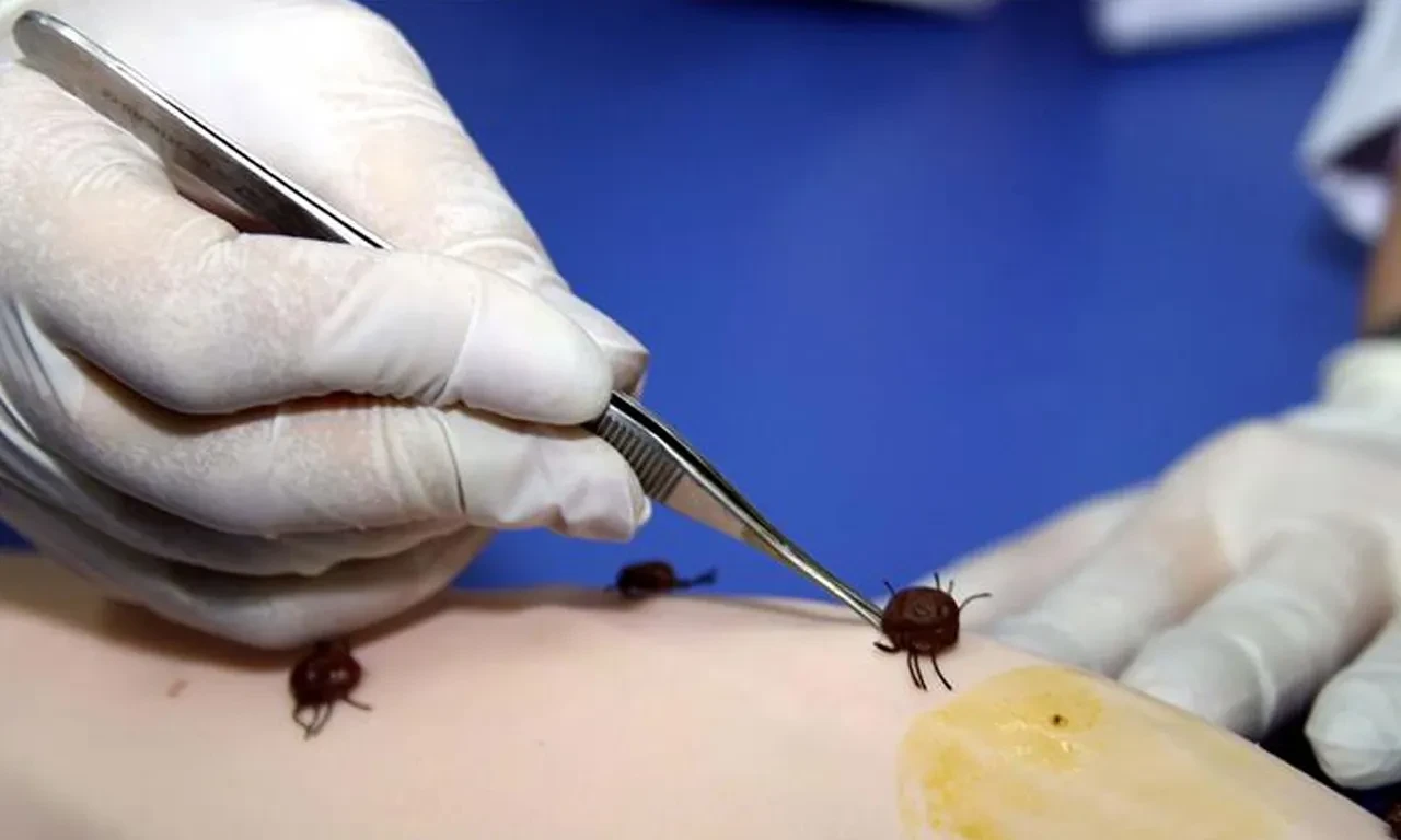 Keneler yeniden hortladı! Uzman isim uyarıları sıraladı: "Bu belirtileri taşıyanlar..."