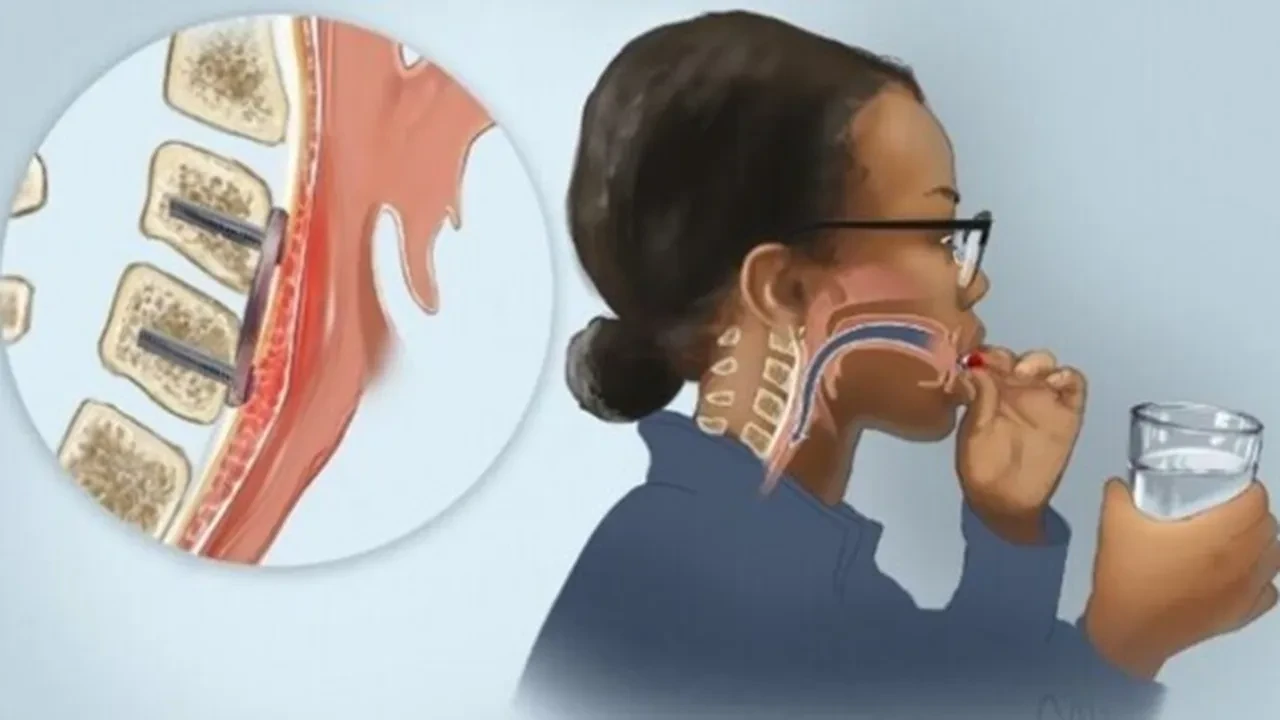 Yutma güçlüğü çekenler dikkat! Erken müdahale hayat kurtarır