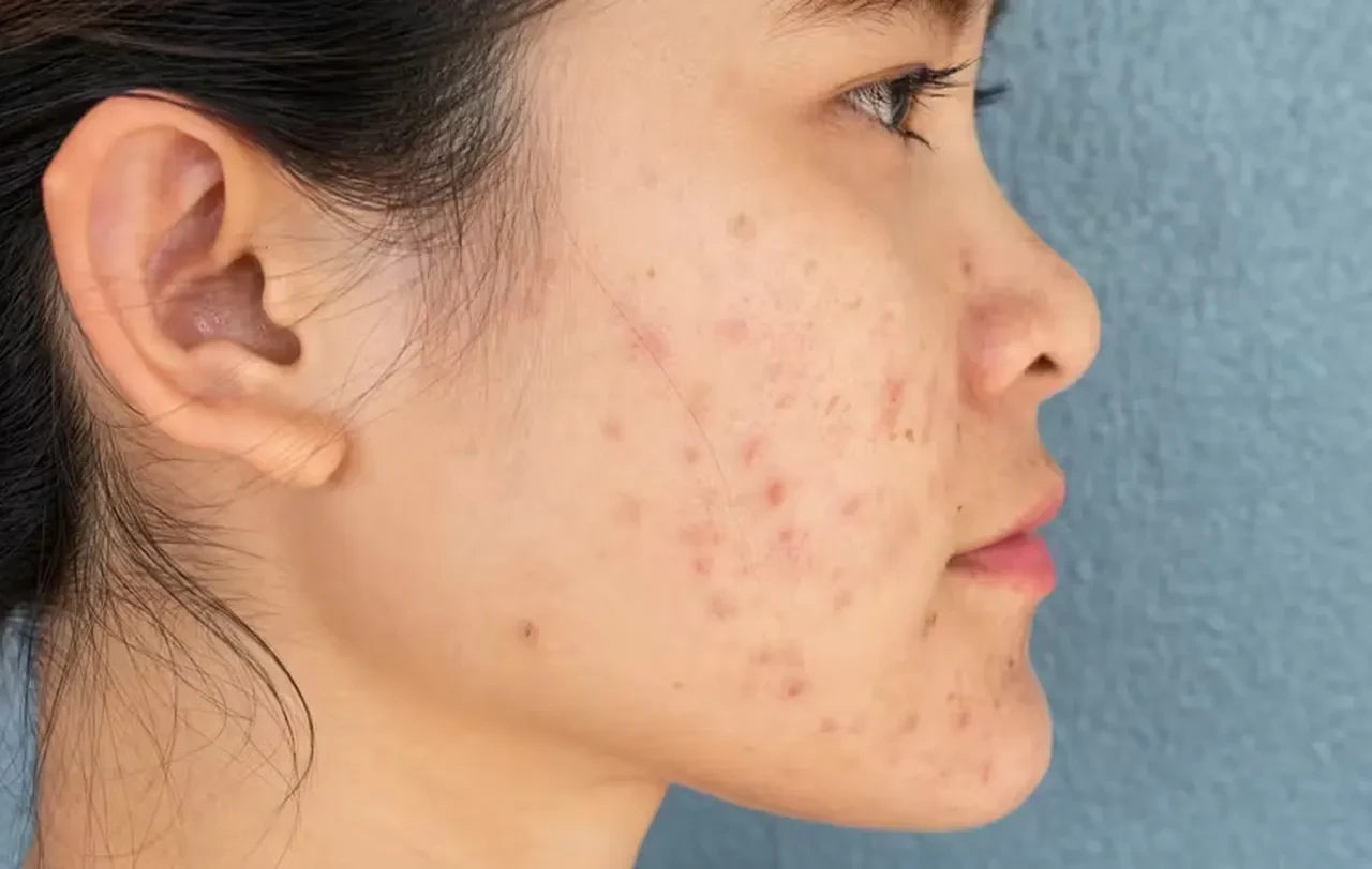 Favori güneş kremi markanız da listede olabilir! Bilim insanları 'Yüzde 75’i etkisiz' dedi