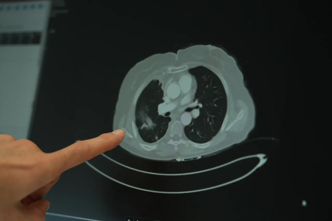 Genç yaşta kanser vakaları neden artıyor? Batı diyeti gençleri vurdu! Uzmanından dikkat çeken uyarı