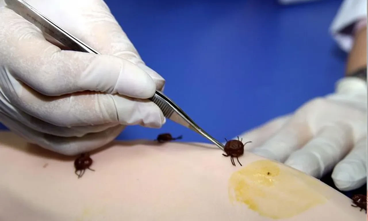 Havalar ısındı, keneler baş gösterdi! Uzmanlar uyardı: Kesinlikle bunu yapmayın!