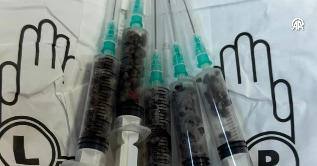 Ameliyatta doktorları şaşkına çevirdi! Say say bitmedi