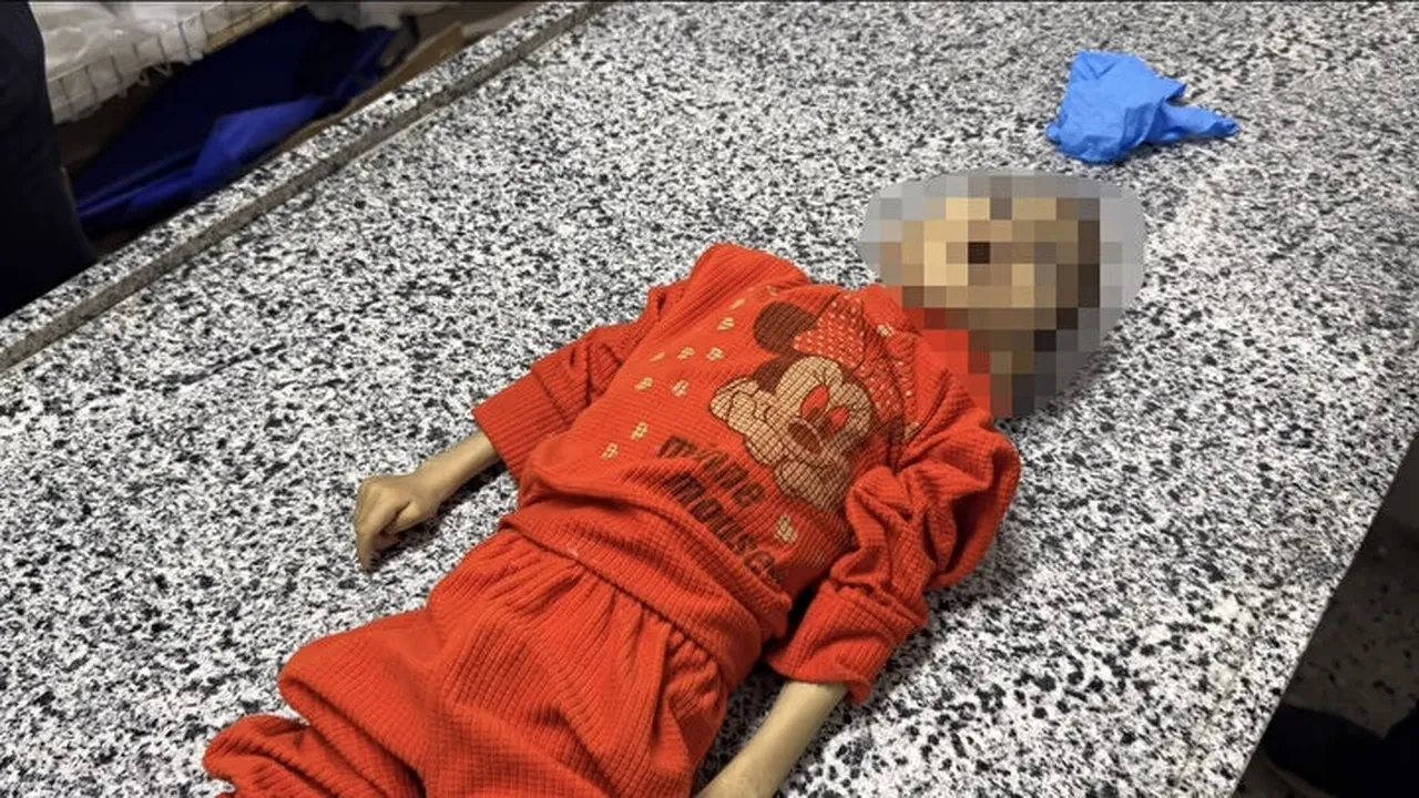 İsrail zulmüne bir can daha! Gazzeli Muhammed Mustafa açlıktan hayatını kaybetti