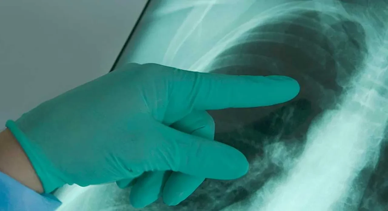 Elektronik sigara hakkında korkunç rapor! Patlamış mısır akciğeri tespiti