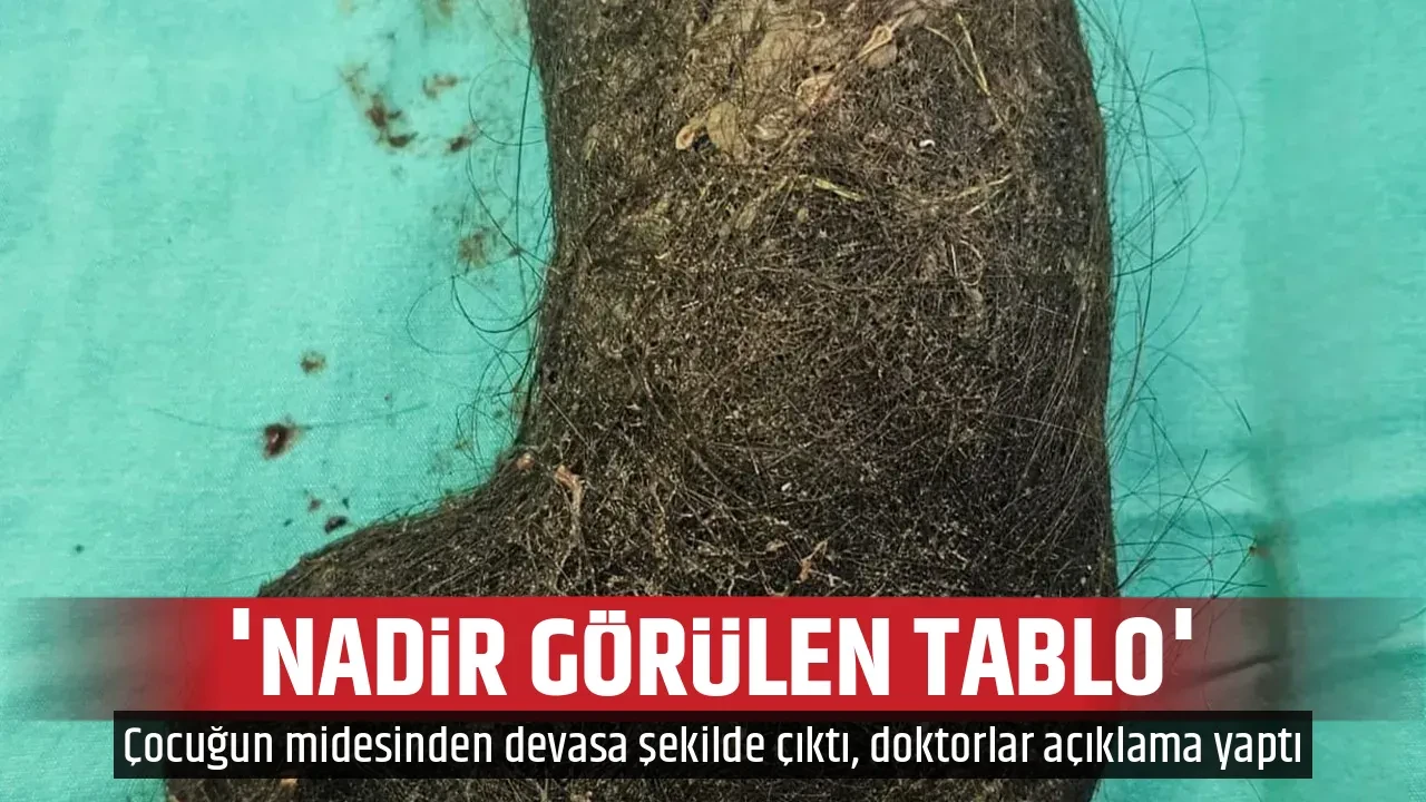 'NADİR GÖRÜLEN TABLO'