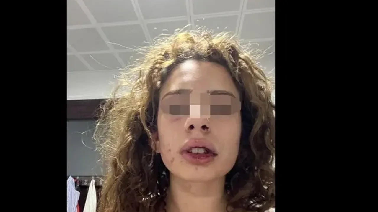 Konya'da dehşet! 'Mezar ayarla' dedi, sevgilisini öldüresiye dövdü: Kan donduran sözler 