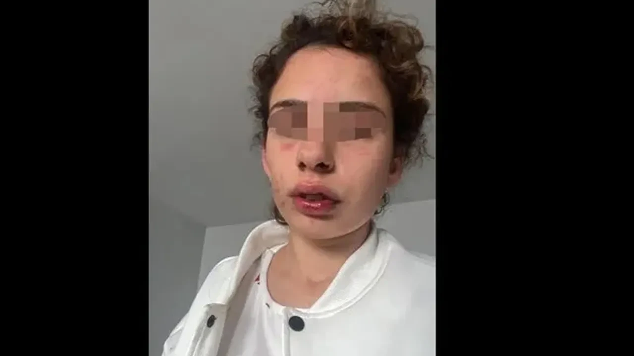 Konya'da dehşet! 'Mezar ayarla' dedi, sevgilisini öldüresiye dövdü: Kan donduran sözler 