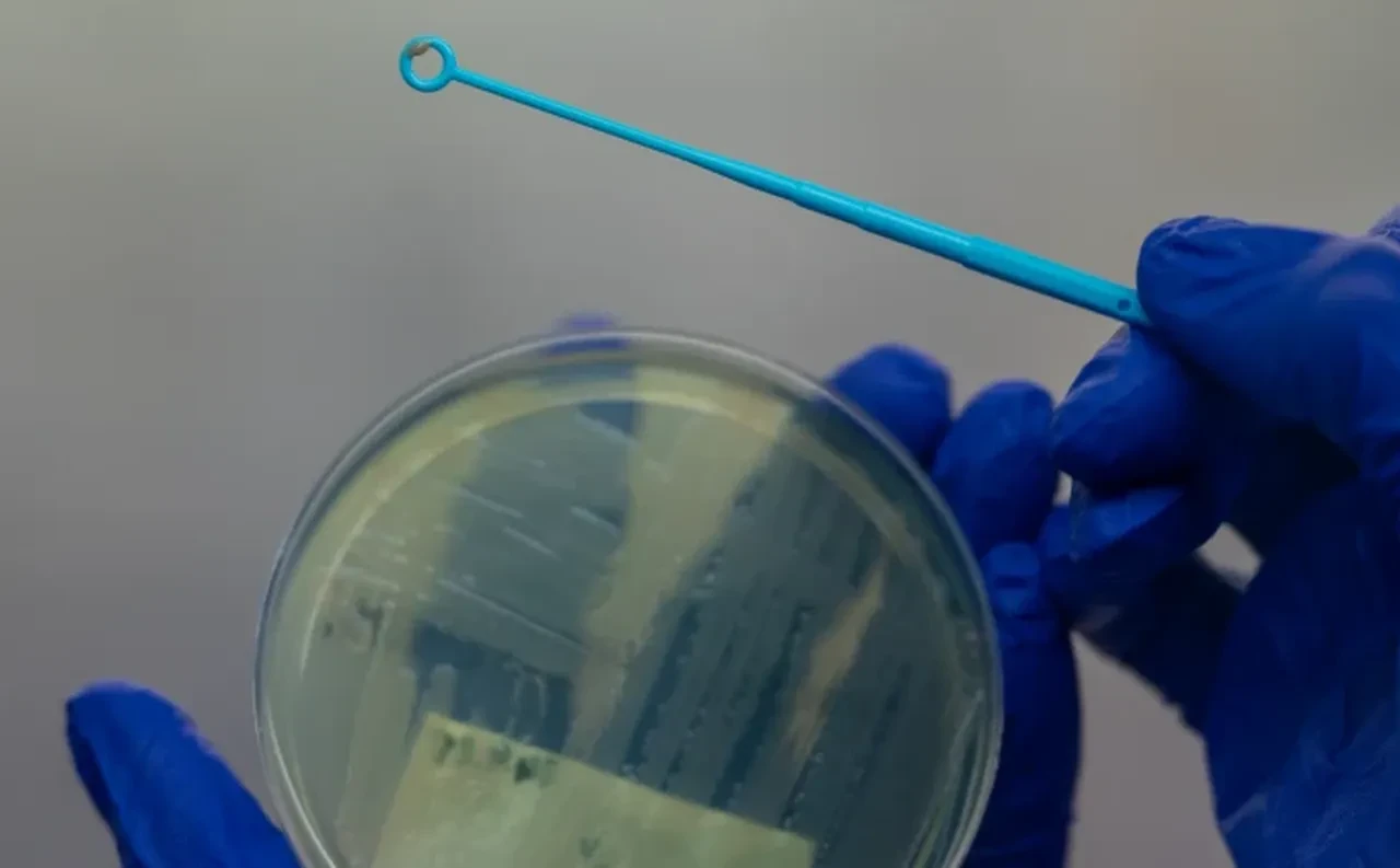 Sağlık sektöründe panik! Hastane cihazlarını yiyen bakteri kabusu!