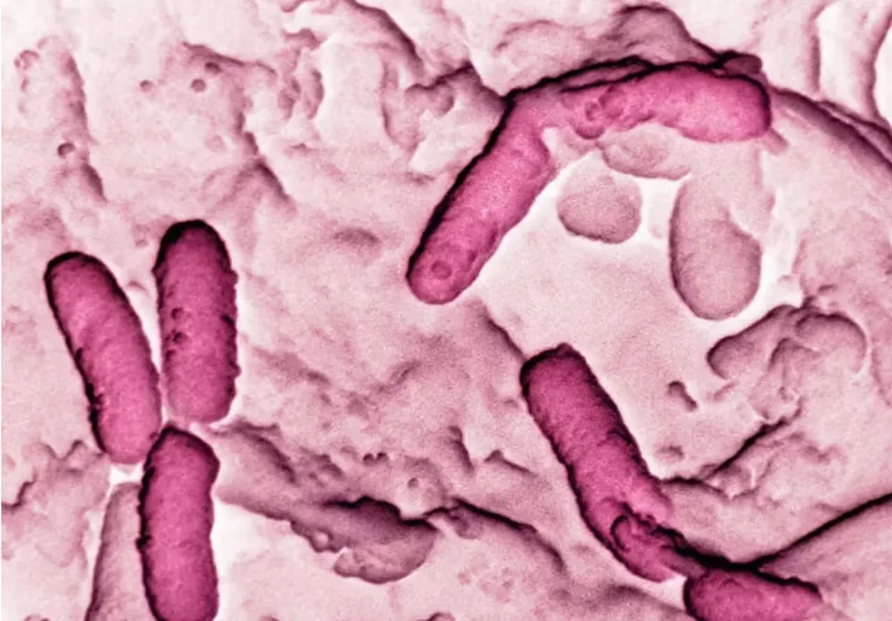 Sağlık sektöründe panik! Hastane cihazlarını yiyen bakteri kabusu!