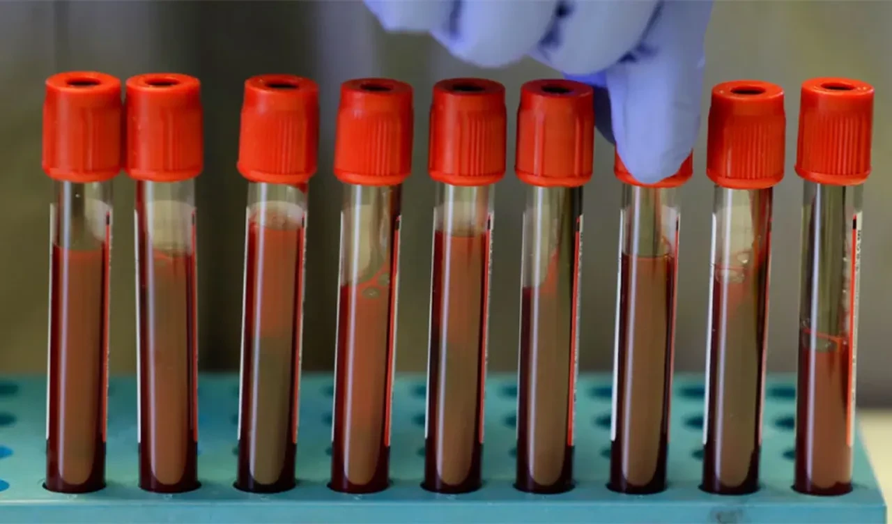 Japonya'dan tıpta çığır açabilecek keşif! Tüm kan gruplarıyla uyumlu 'yapay kan' geliştirildi