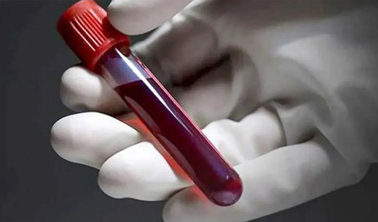 Japonya'dan tıpta çığır açabilecek keşif! Tüm kan gruplarıyla uyumlu 'yapay kan' geliştirildi