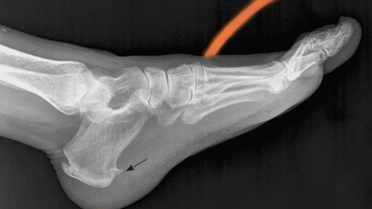 Sabah ilk adımda başlayan ağrının sebebini uzmanı açıkladı