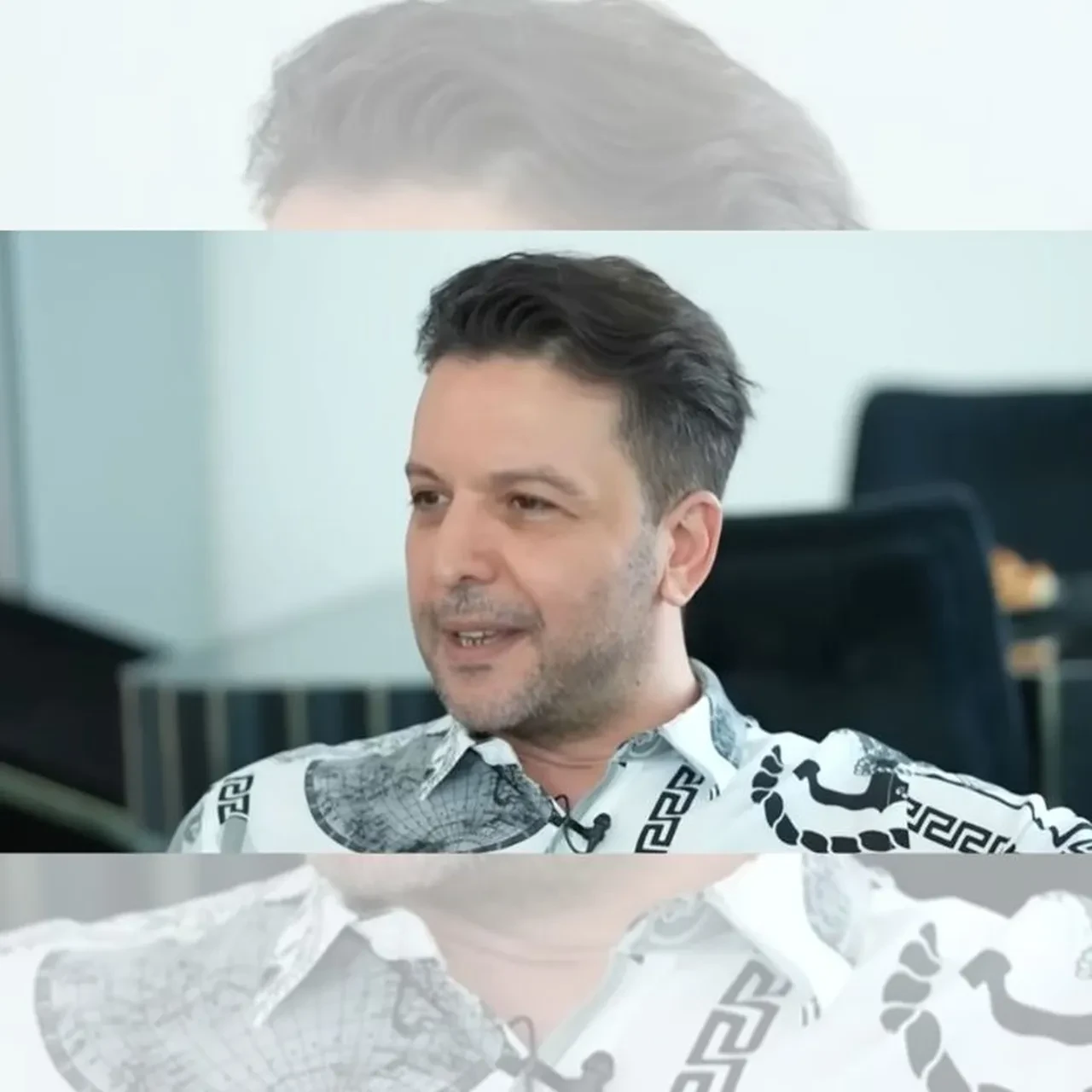 Nihat Doğan estetikle bambaşka birine dönüştü! 