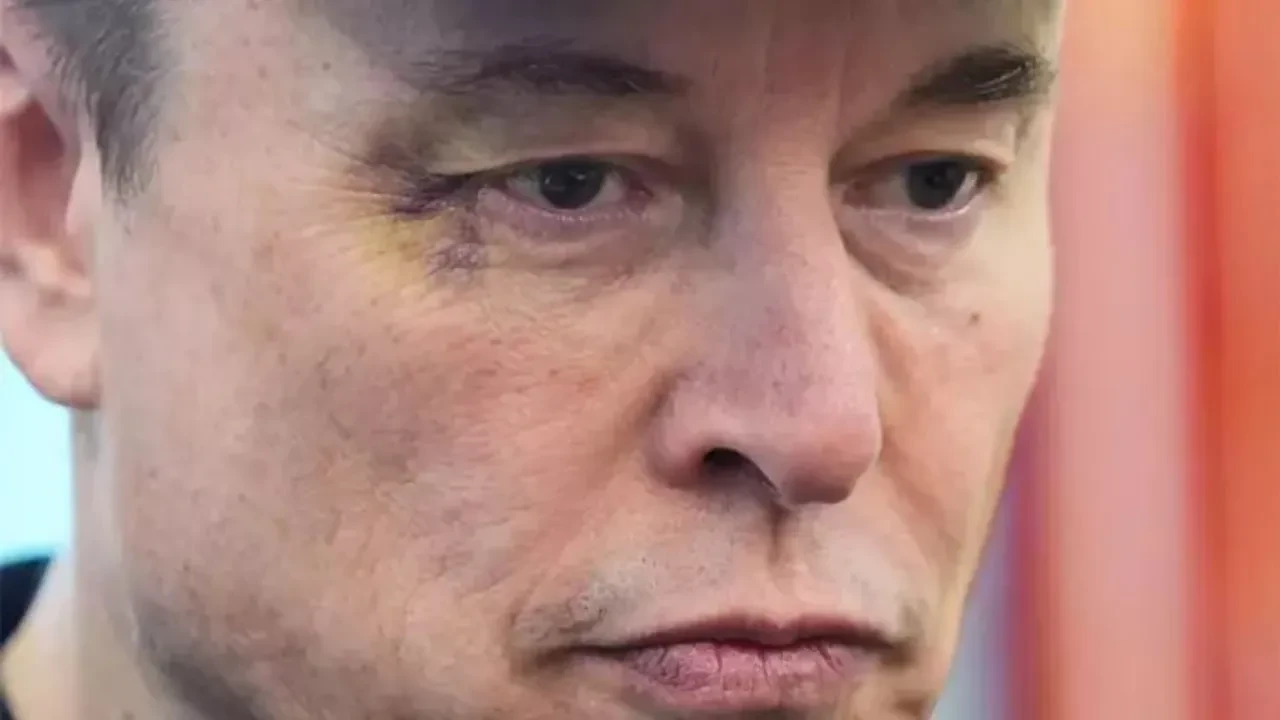 Elon Musk gözündeki morluğun sebebini açıkladı: Vur dedim, gerçekten vurdu...