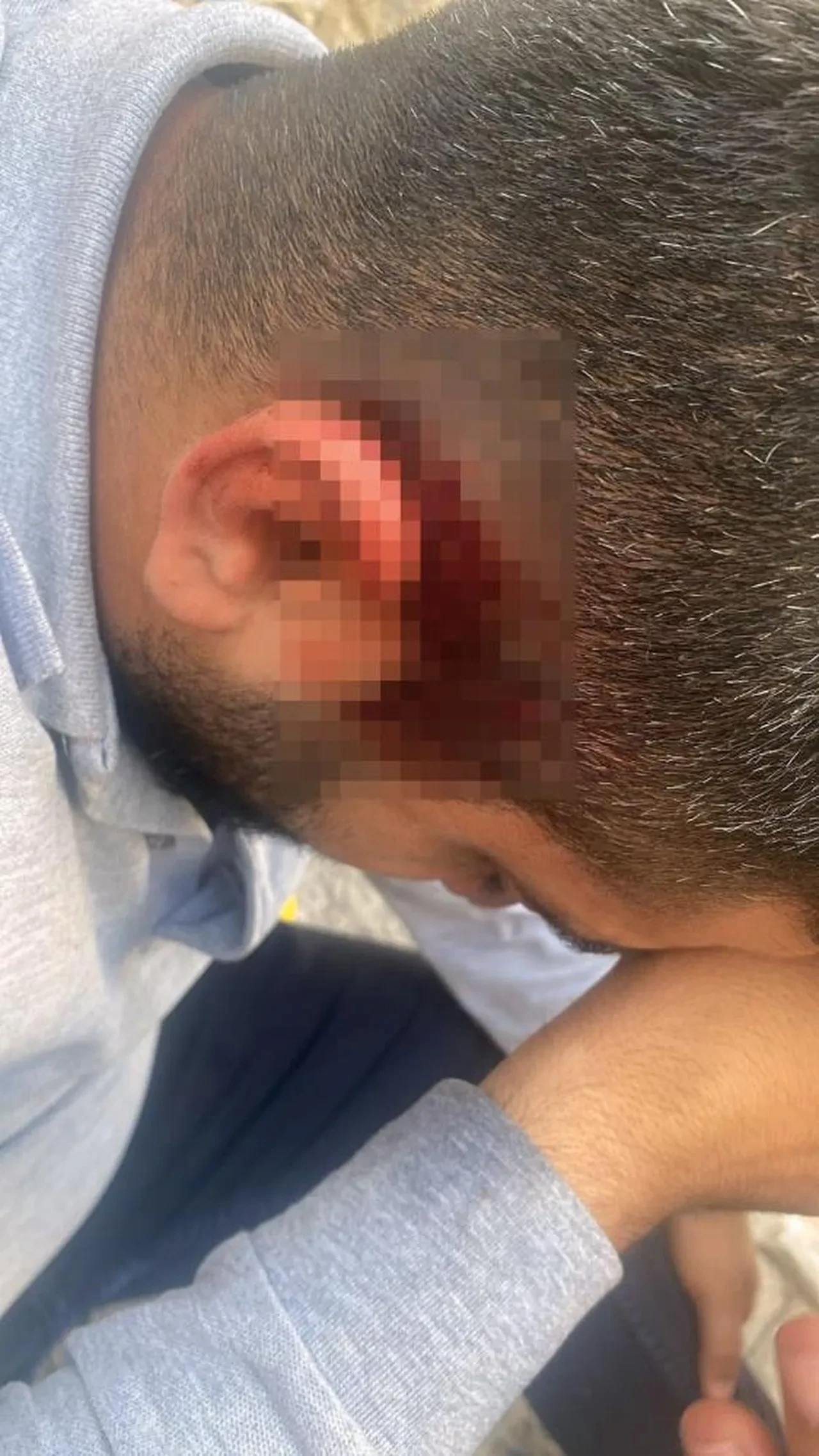 Hem suçlu hem güçlüler! Şırnak'ta elektrik personeline taşlı saldırı! Kaçak trafo ölüm getirdi