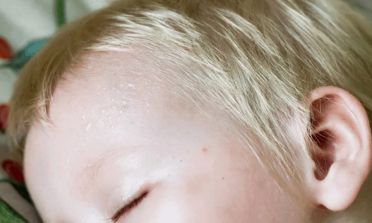 Anne ve babalar dikkat! Çocuklardaki aşırı terlemeyi hafife almayın: Habercisi olabilir