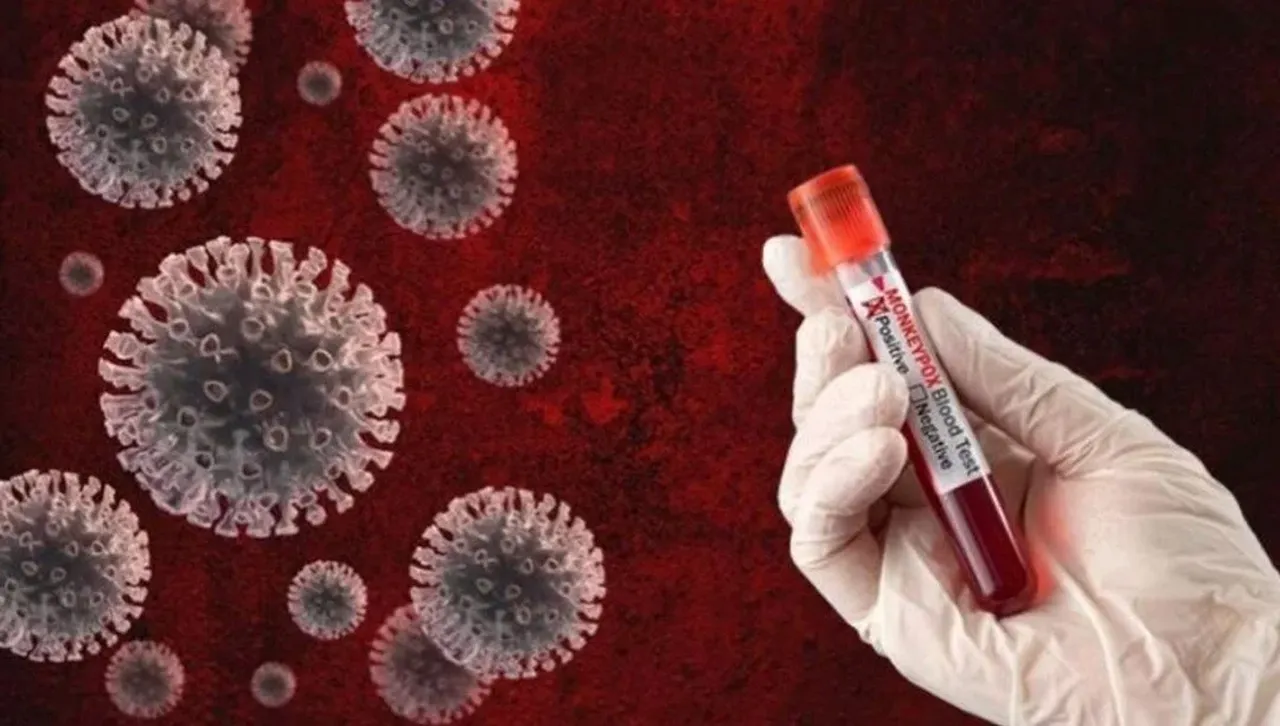 Hem hayvan hem de insanlardan bulaşan virüs için alarm verildi? Vakalar artıyor