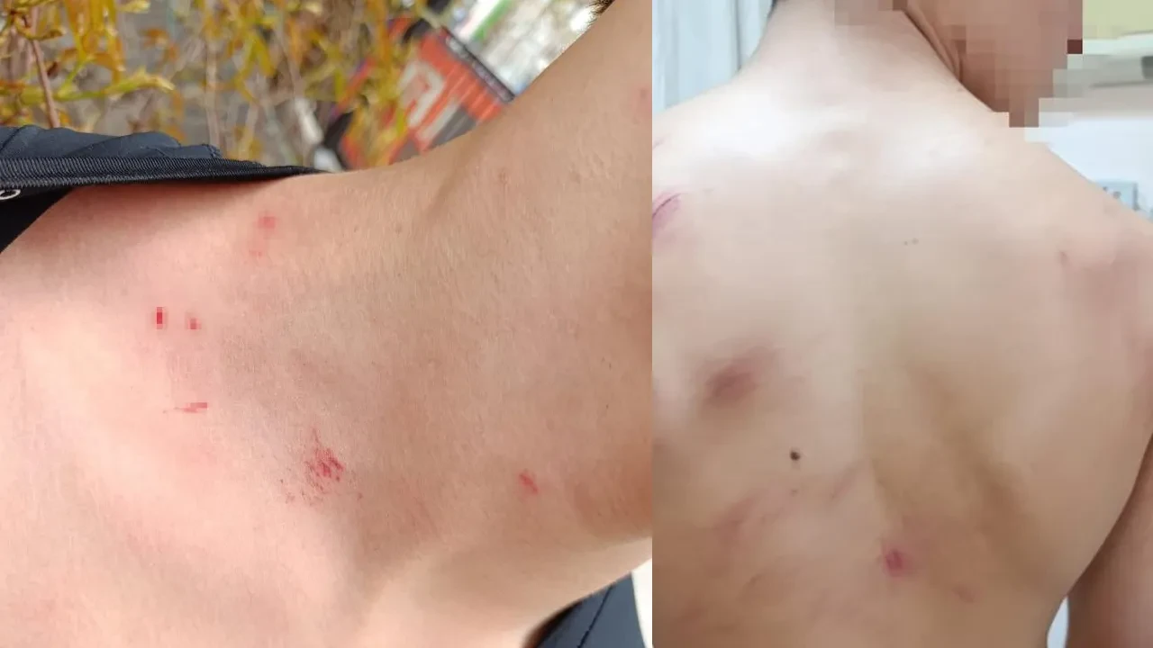 Ankara'da 14 yaşındaki çocuğa öldüresiye darp! Boğazını sıkıp çatıdan attı 