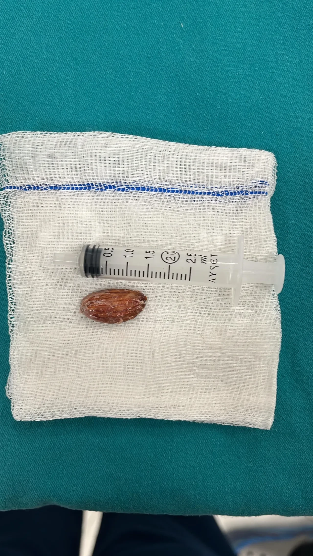 Daha doğalı 16 gün olmuştu! Ağabeyi küçük bebeği ölümle burun buruna getirdi