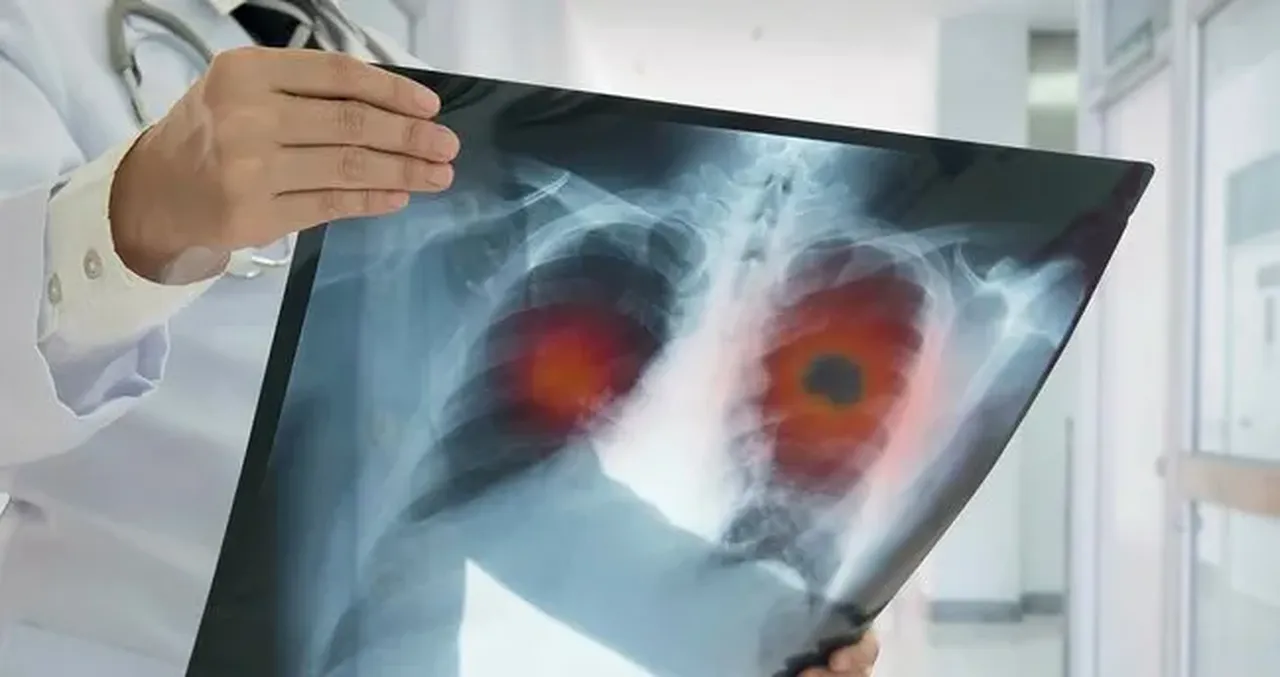 Her yıl 4 milyondan fazla kişi bu sebepten hayatını kaybediyor