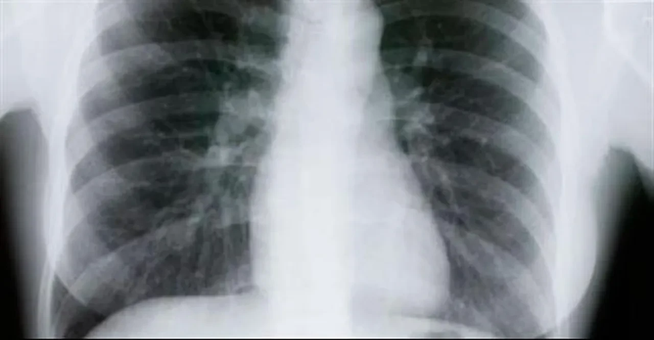 Her yıl 4 milyondan fazla kişi bu sebepten hayatını kaybediyor