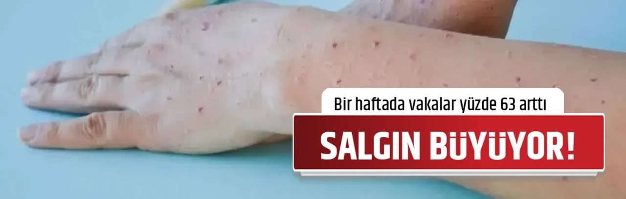 SALGIN BÜYÜYOR!