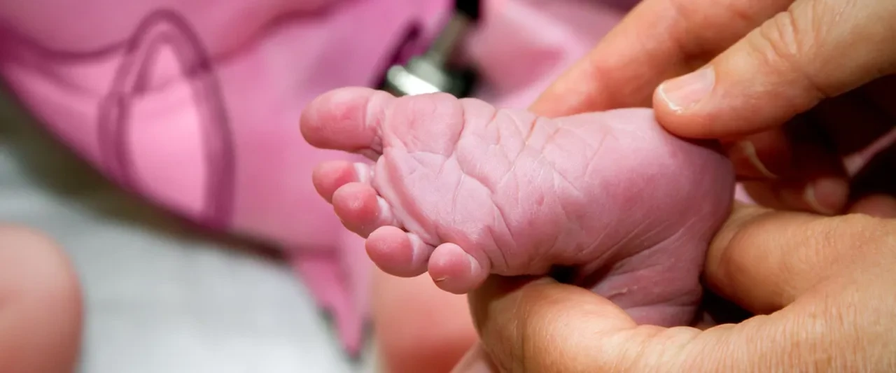 Fenilketonüri hastalığı nedir nelere dikkat etmeli? Türkiye'de her 25 kişiden biri