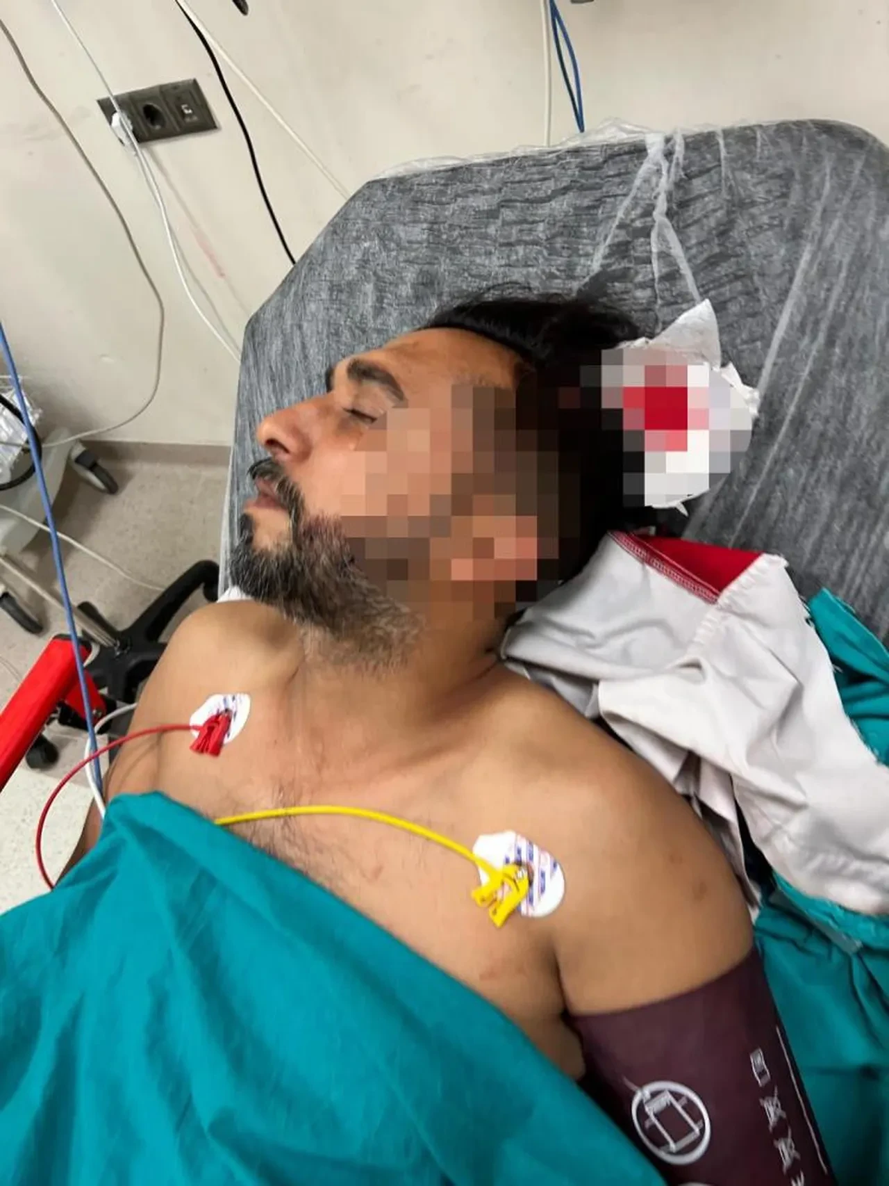 Adana'da ilginç olay: Döner keserken başına mermi saplandı