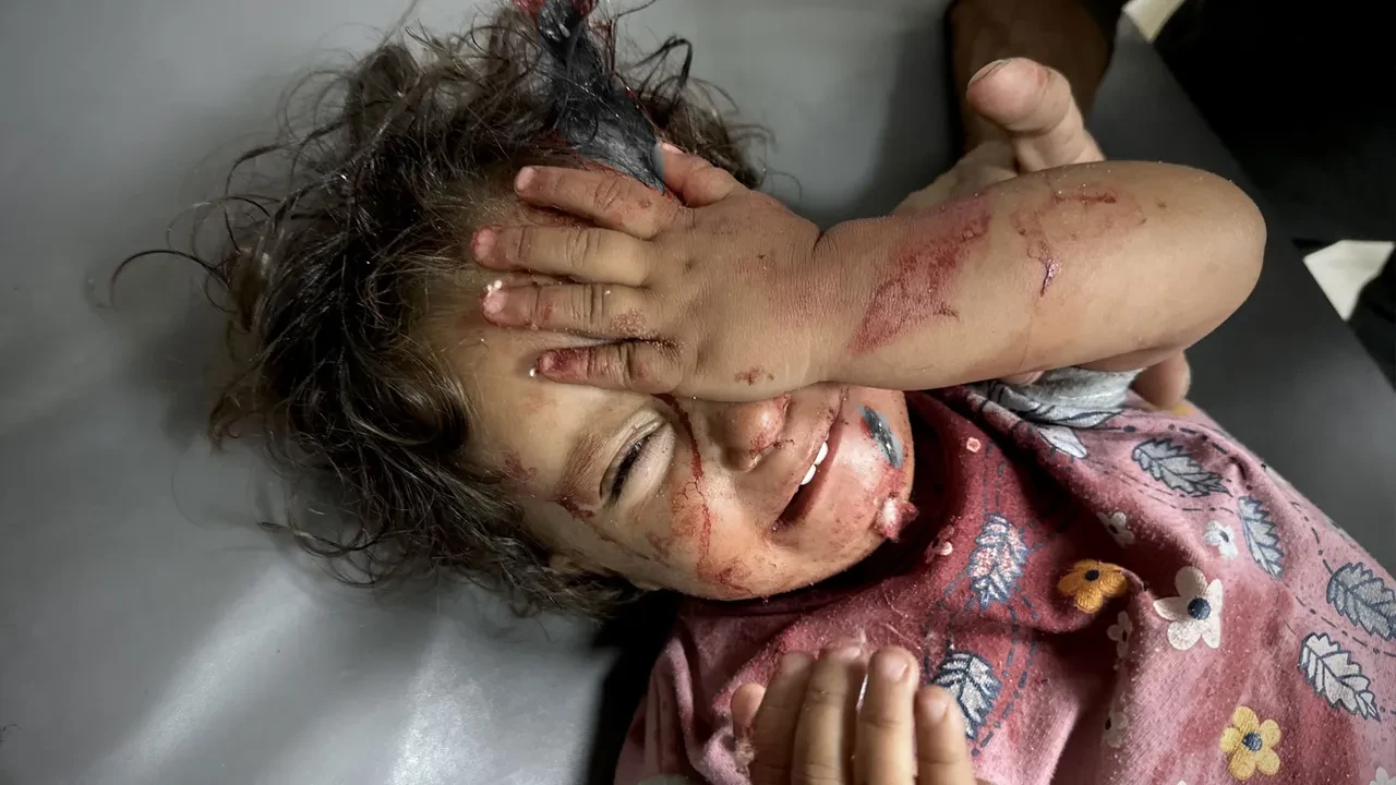 Gazze'de acı bilanço! İsrail'in katliamlarında ölenlerin sayısı 55 bini aştı